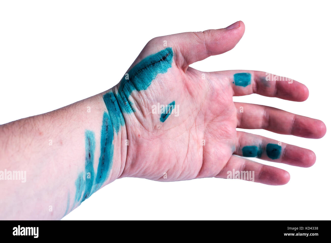 Scar hand hi-res stock photography and images - Alamy