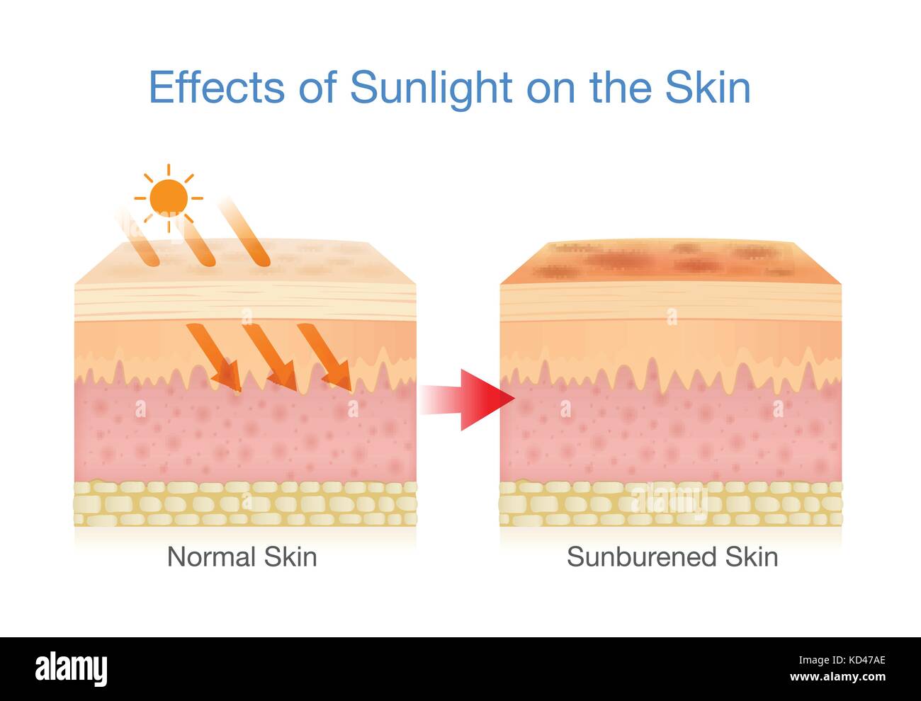 Effect of sunlight on skin. Stock Vector