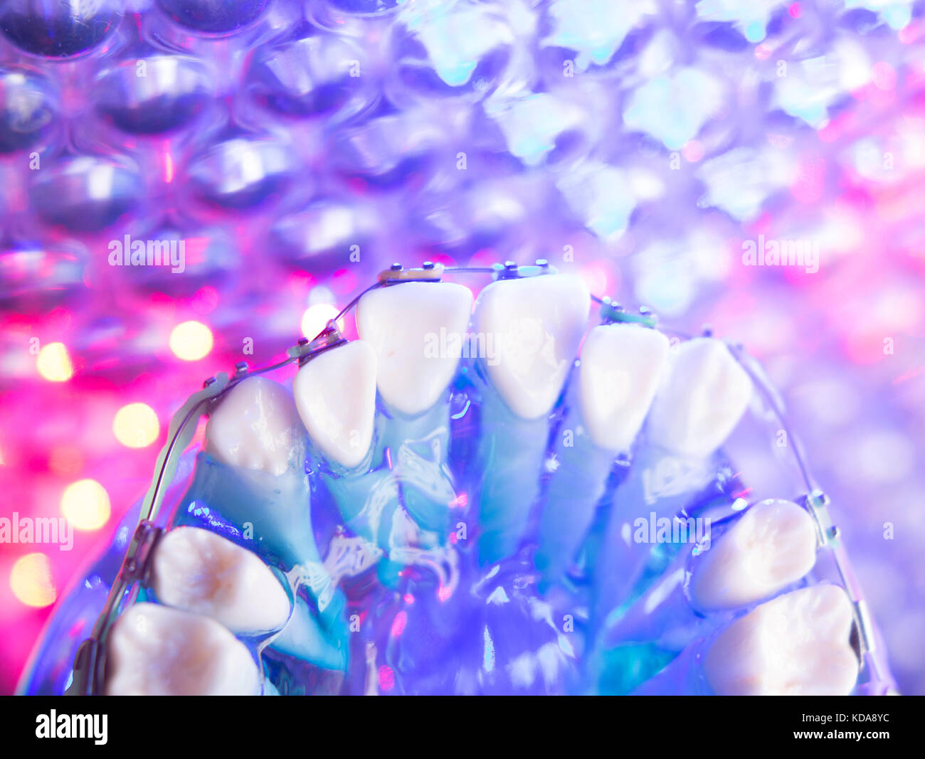 Dental teeth retainers metal aligners brackets to straighten teeth in orthodontic dentistry