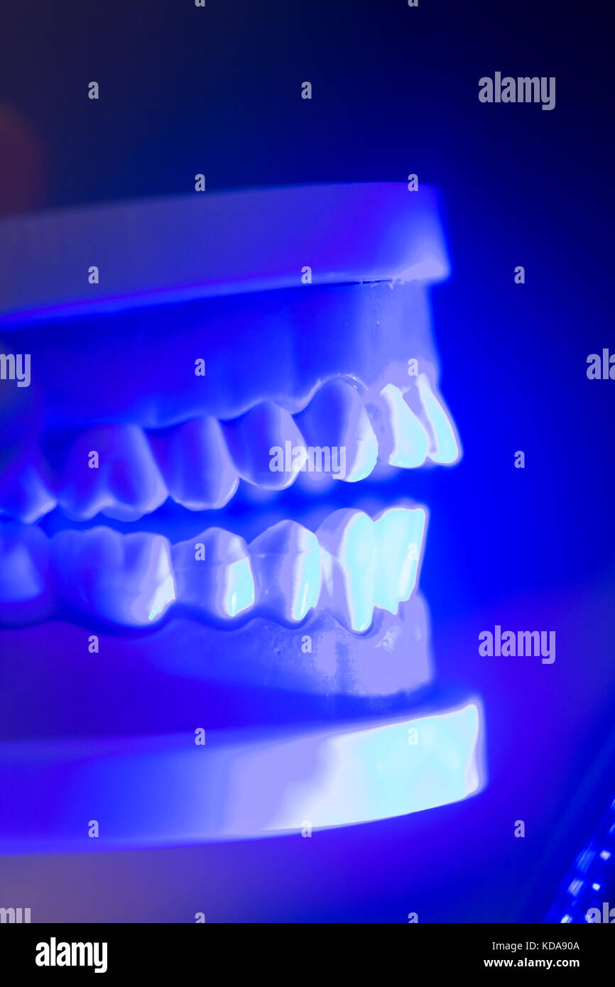 Dental teeth orthodontic dentistry teachng model with gums, tooth