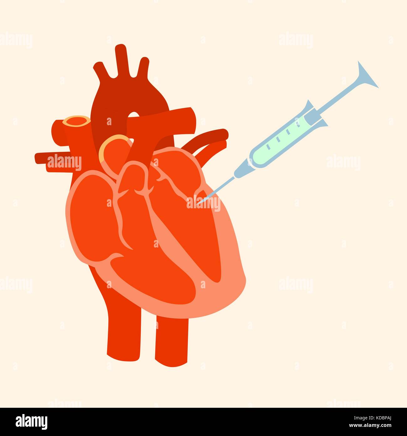 The human heart with a syringe. Flat design style illustration. Stock Vector