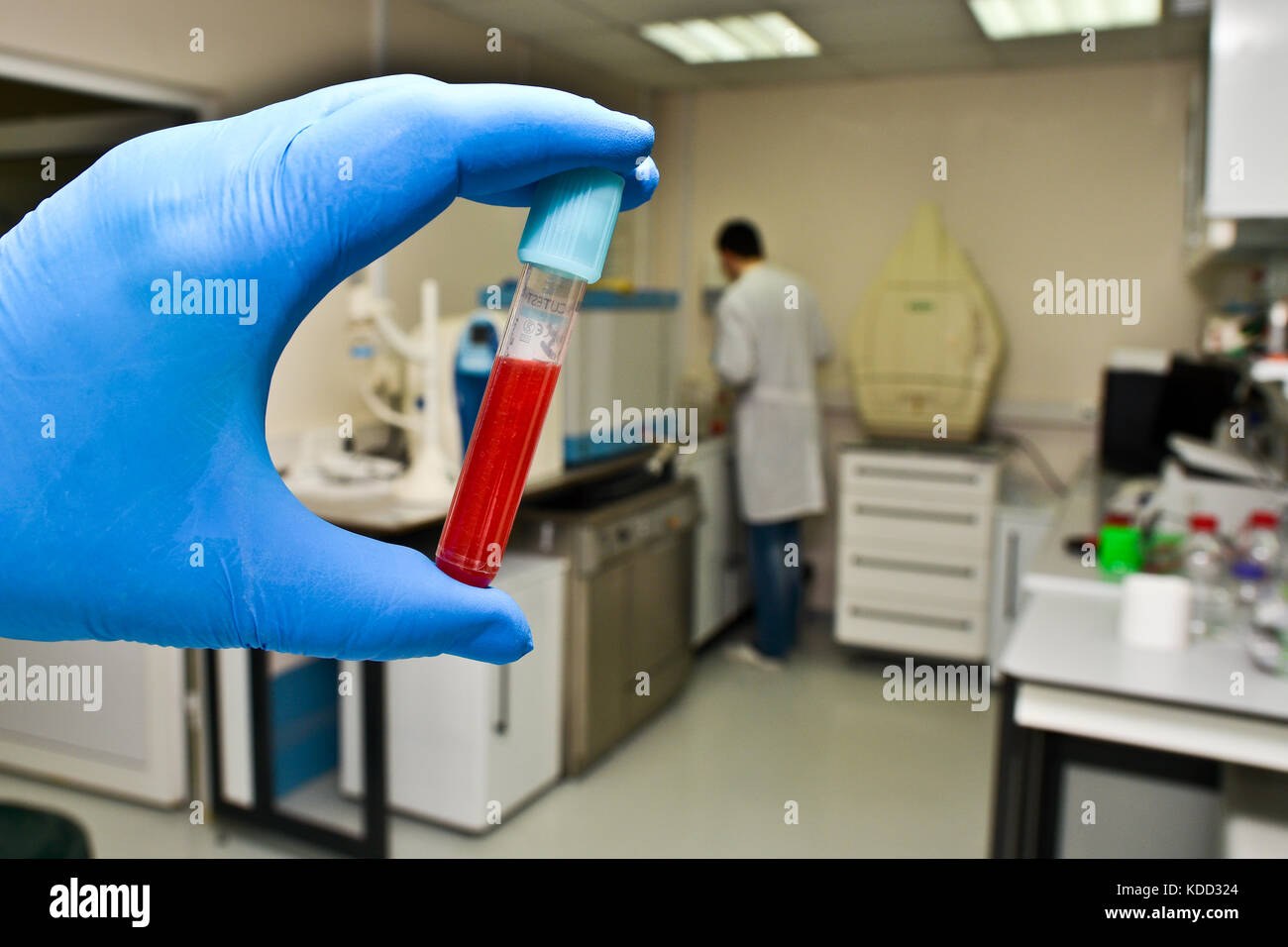 Blood test in the laboratory. A test tube with a biological sample in