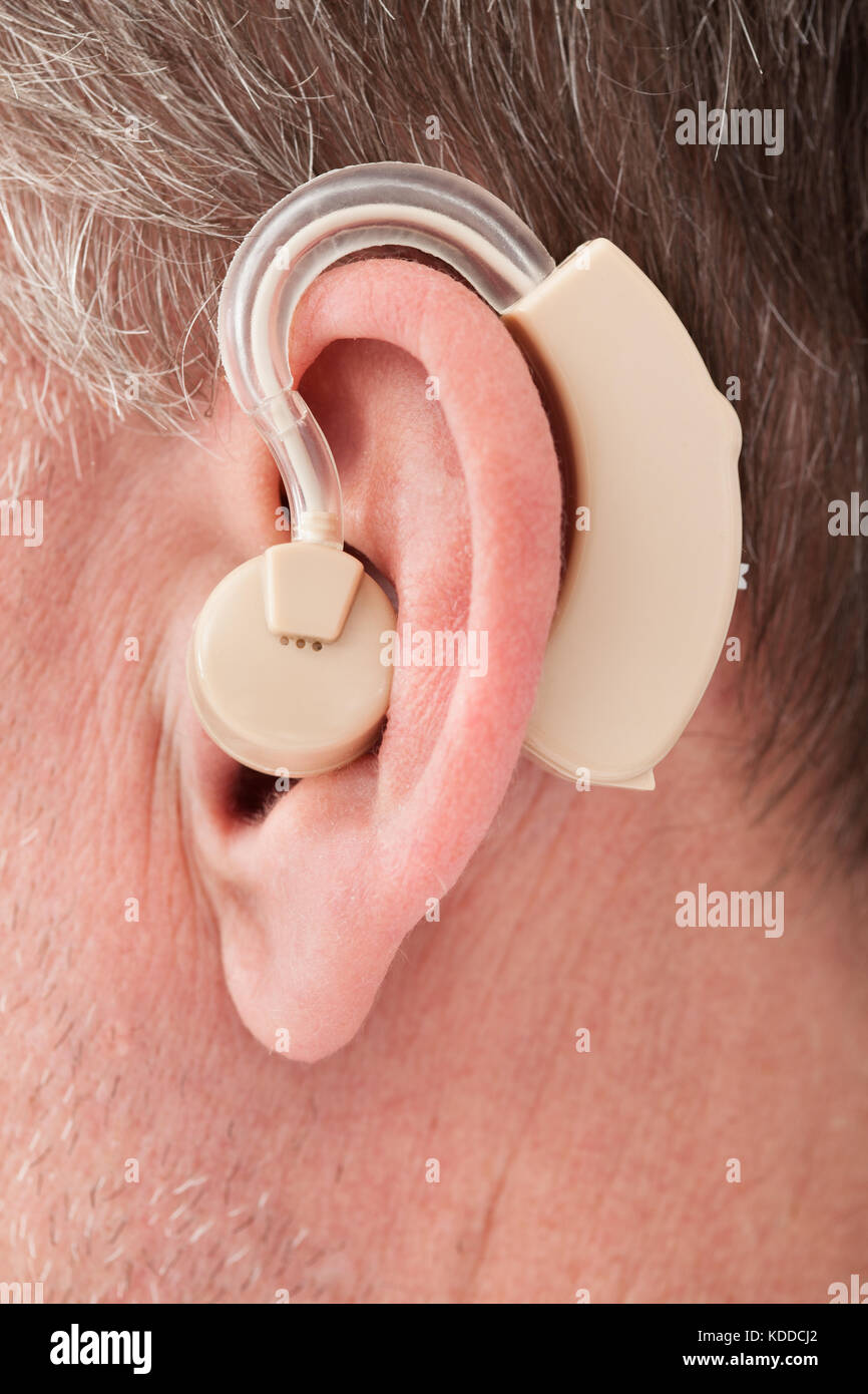 Слуховой Аппарат У 03 Купить