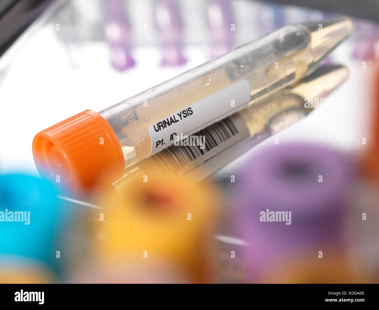 Urine sample sitting on a surgical tray Stock Photo Alamy