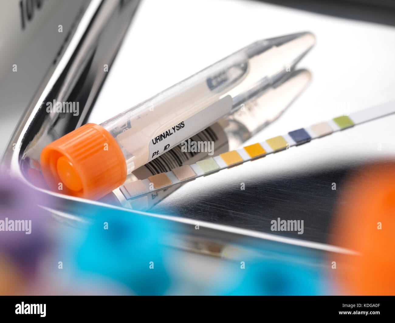 Urine sample and diagnostic chart sitting on a surgical tray Stock