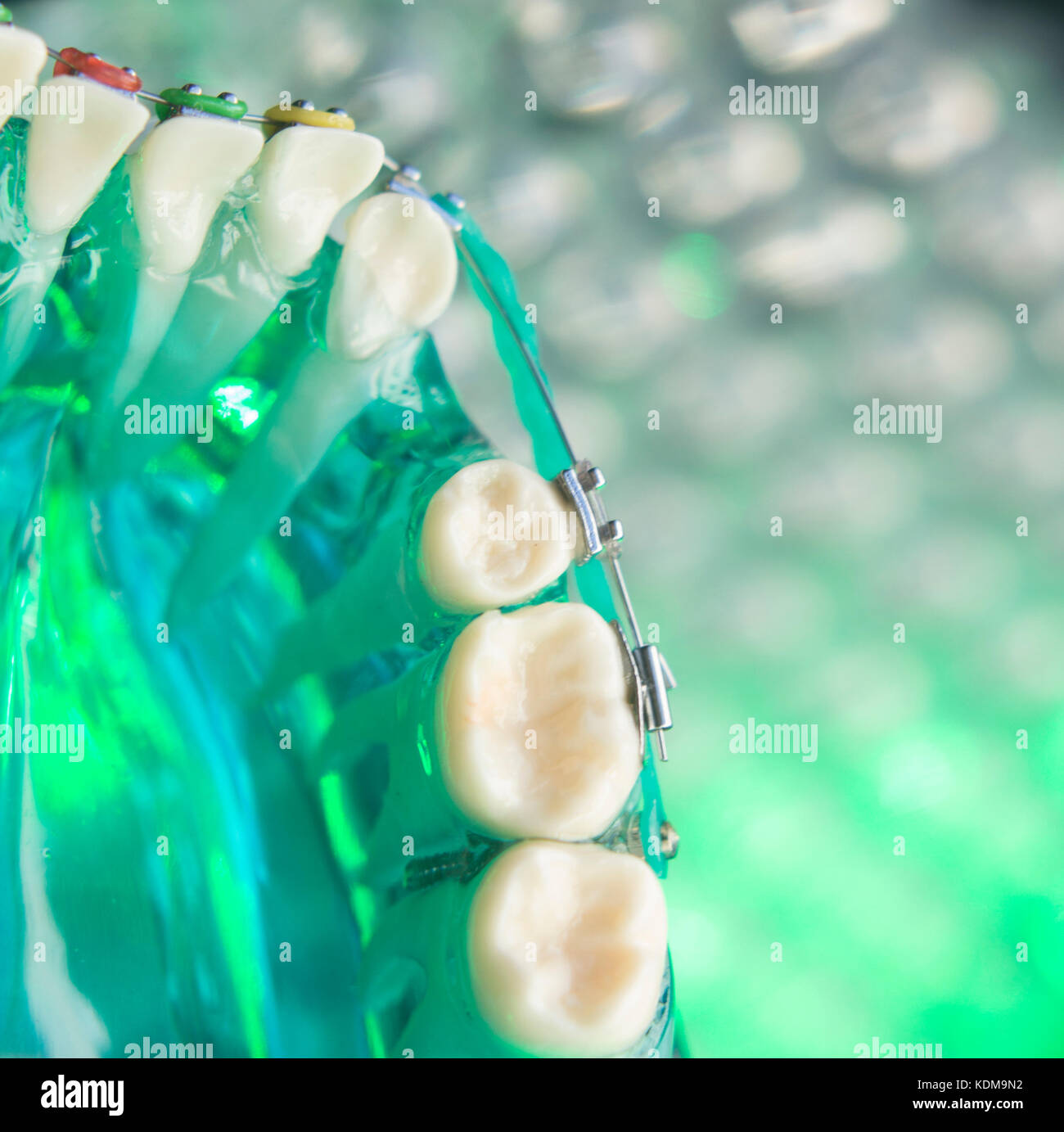 Dental teeth retainers metal aligners brackets to straighten teeth in orthodontic dentistry