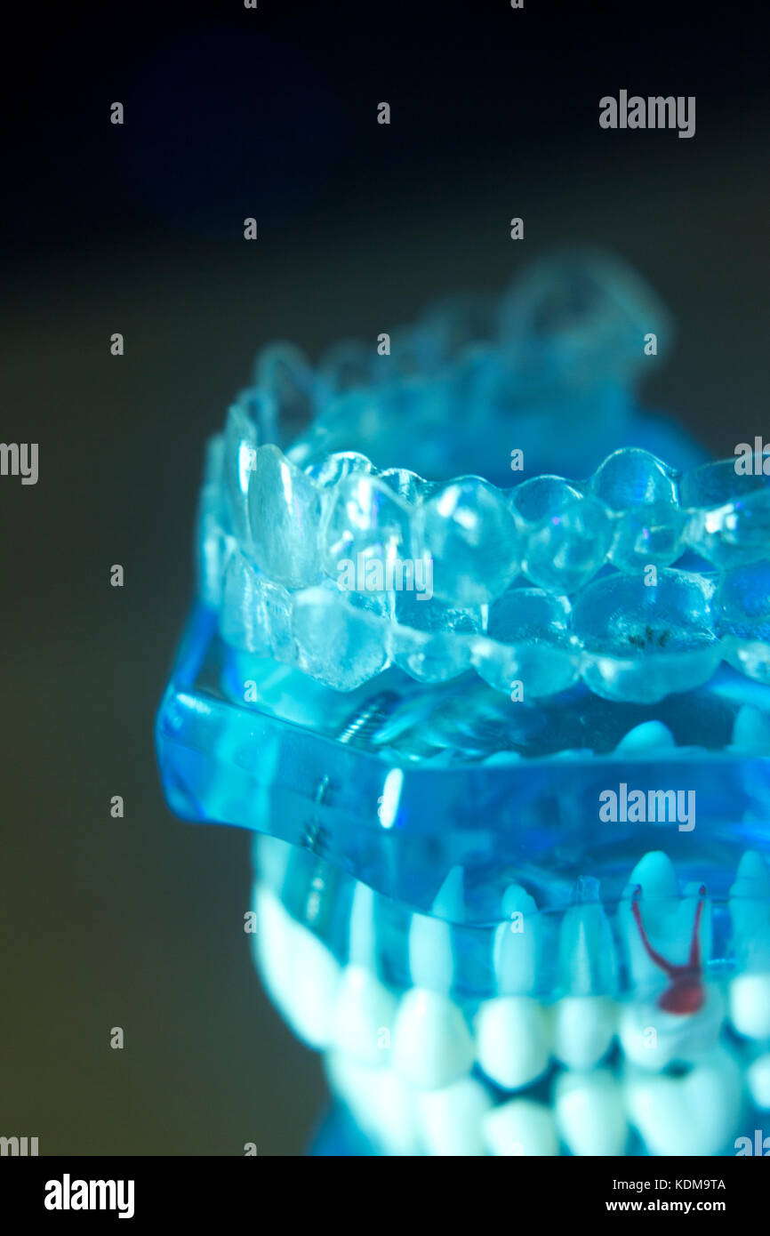 Dental teeth orthodontic dentistry teachng model with gums, tooth