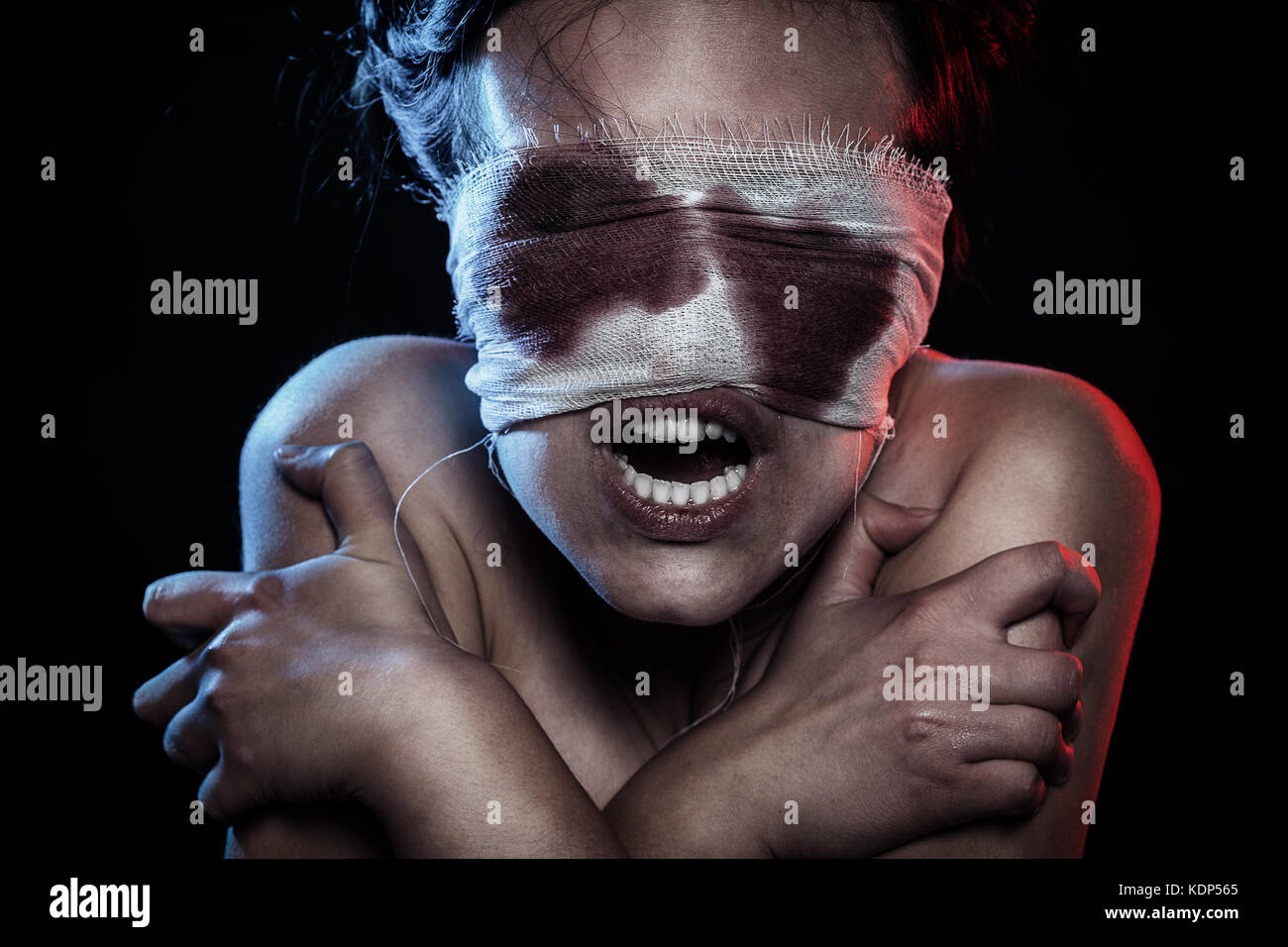 screaming crazy wounded bloody woman on black background Stock Photo