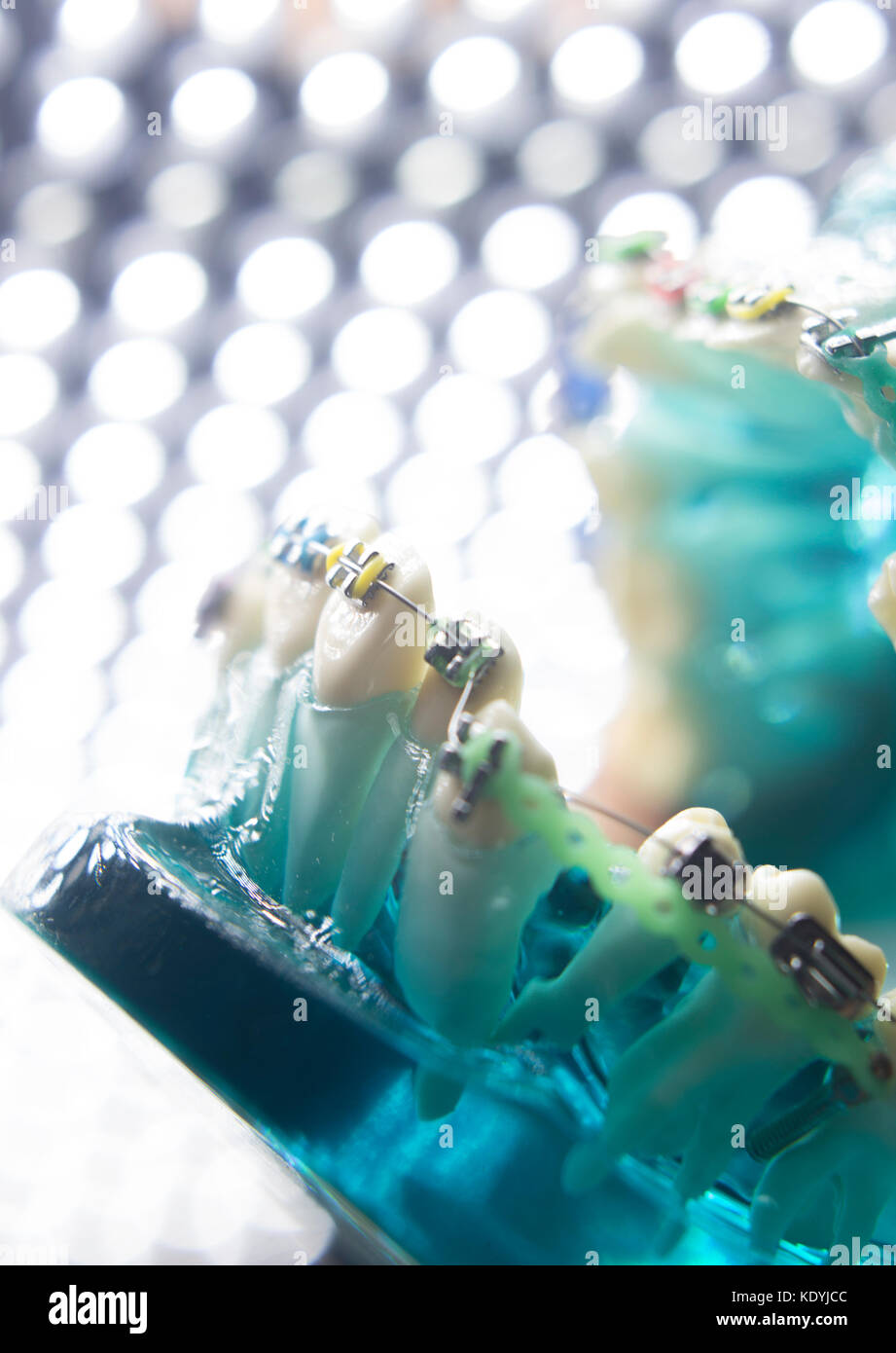 Dental teeth retainers metal aligners brackets to straighten teeth in orthodontic dentistry