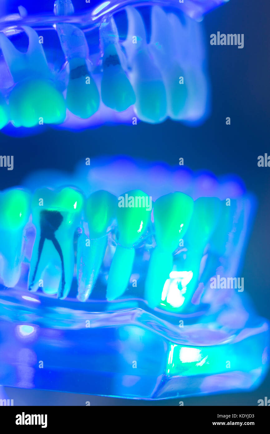 Dental teeth orthodontic dentistry teachng model with gums, tooth