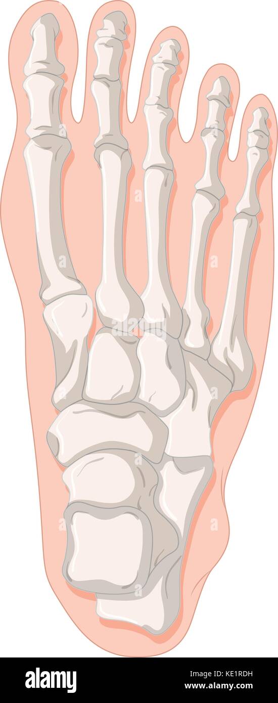 Bone x-ray for gout toe illustration Stock Vector