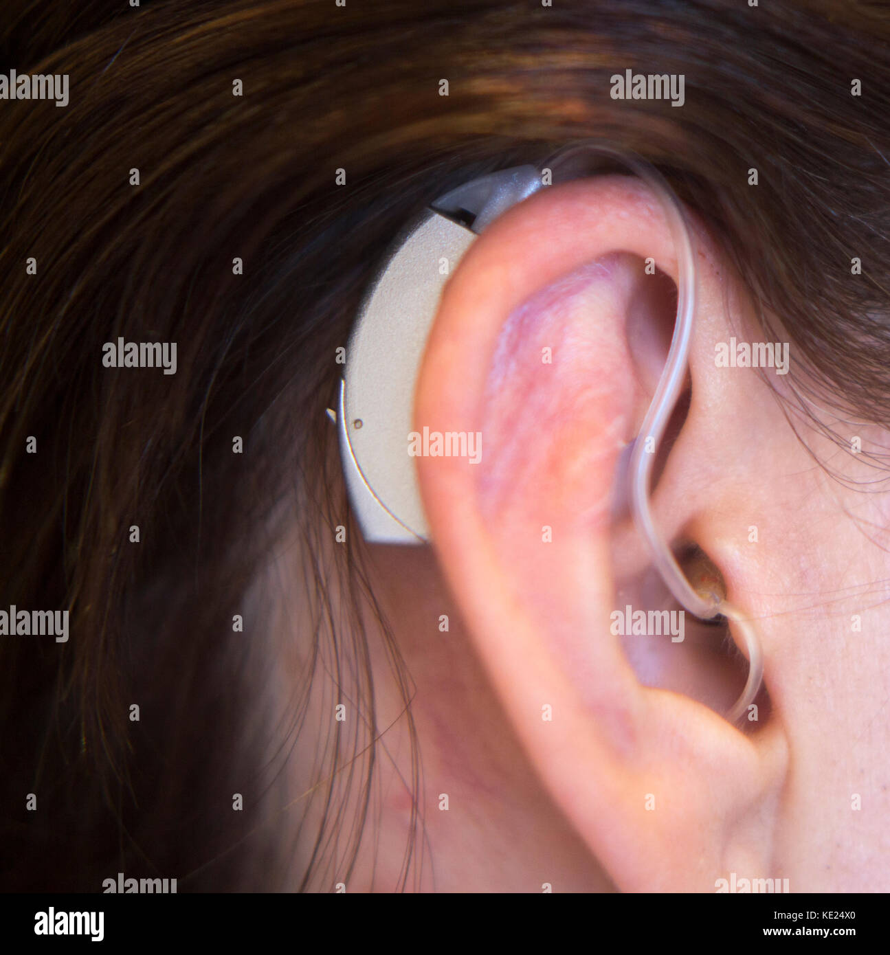 Modern digital in the ear hearing aid for deafness and the hard of