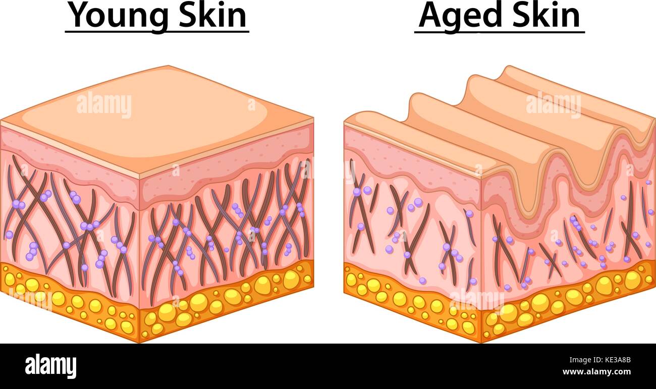 Diagram showing young and aged skin illustration Stock Vector Image ...