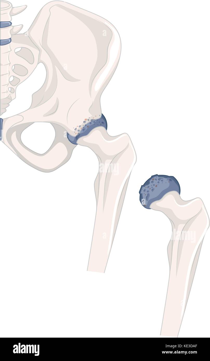 Anatomy Hip Joint Diagram Stock Photos & Anatomy Hip Joint Diagram