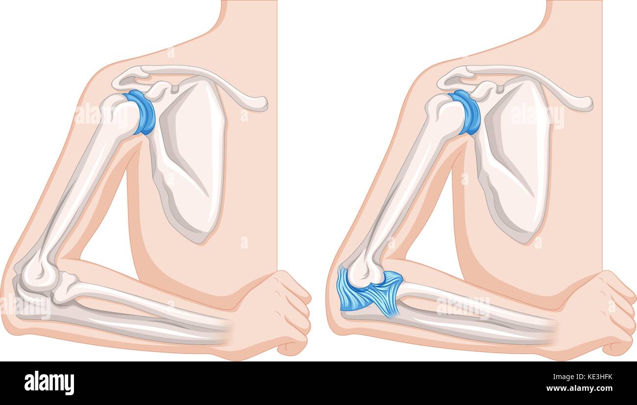Close up diagram of human elbow joints illustration Stock Vector Image