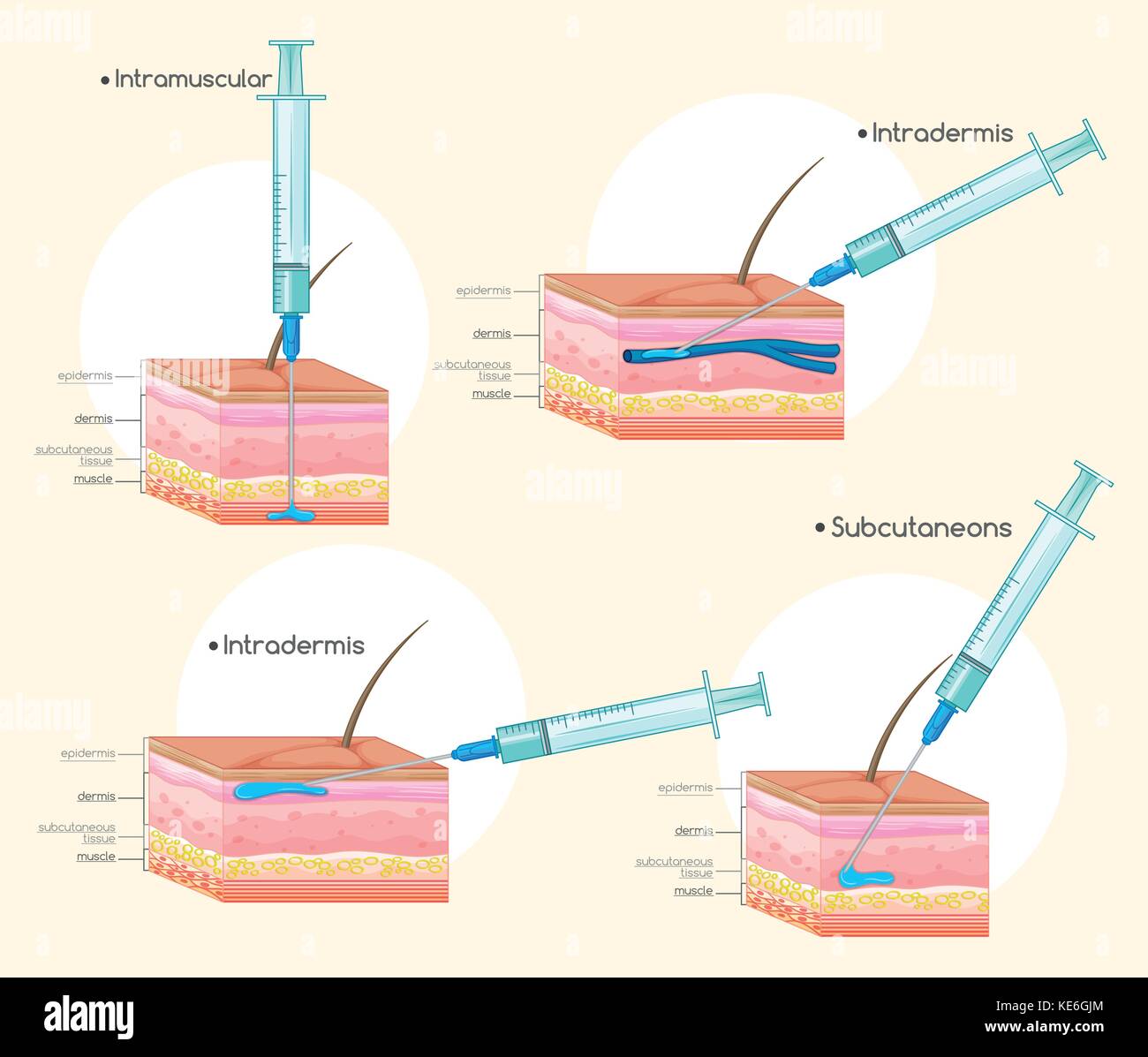 Different types of injections illustration Stock Vector Image & Art Alamy