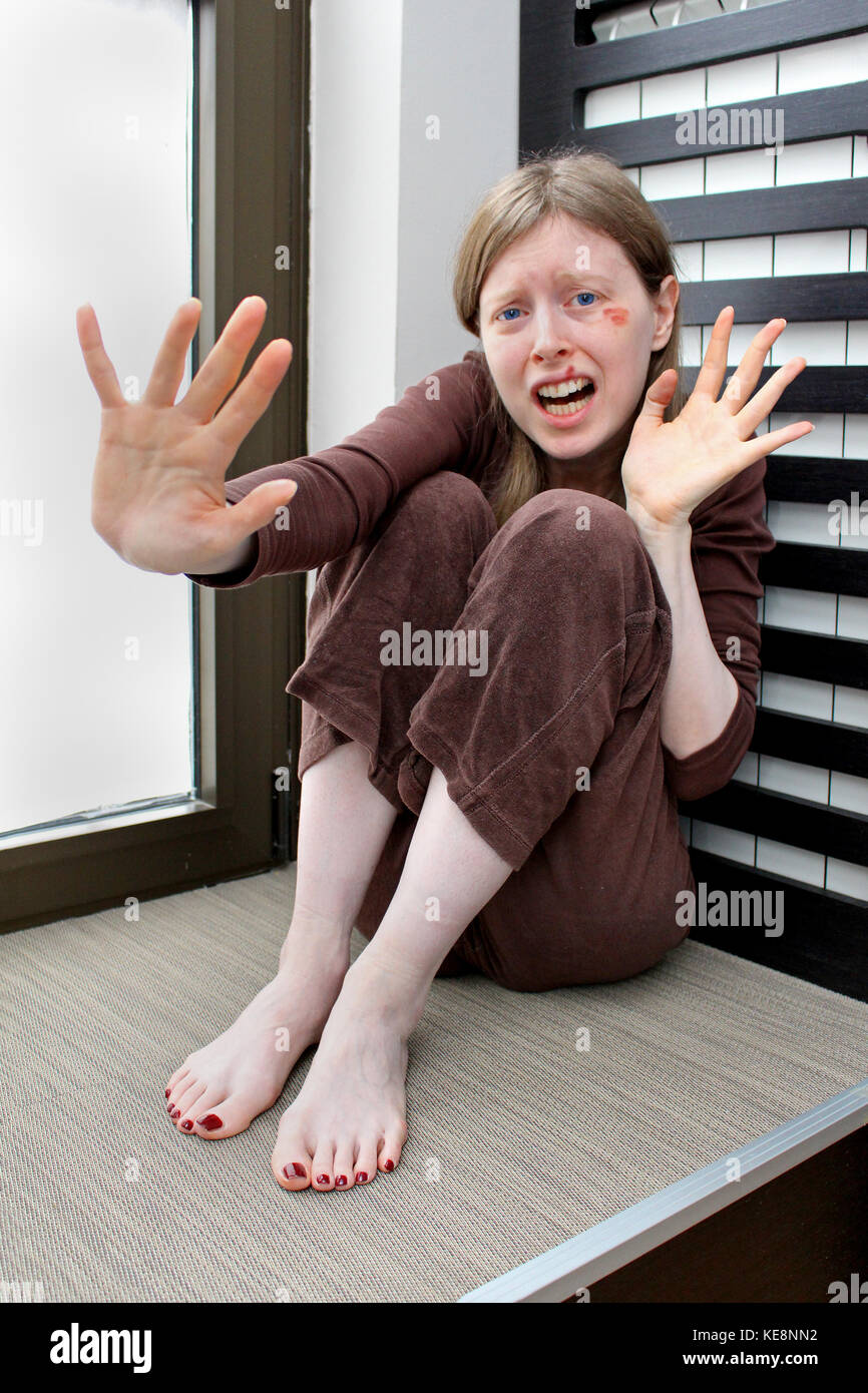 Woman suffering from abusive relationship with bruised aye and torn lip  Stock Photo - Alamy