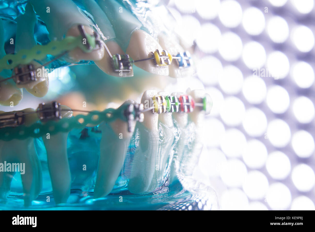 Dental teeth retainers metal aligners brackets to straighten teeth in