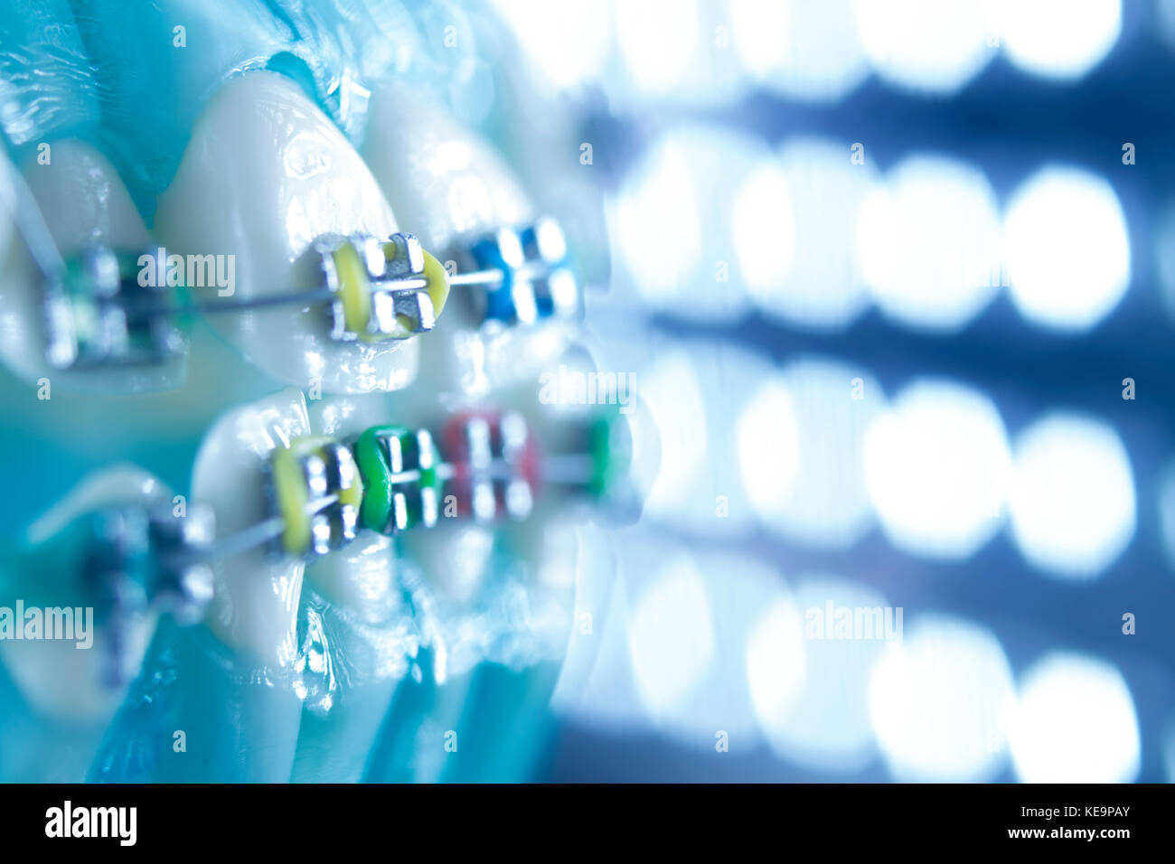 Dental teeth retainers metal aligners brackets to straighten teeth in orthodontic dentistry