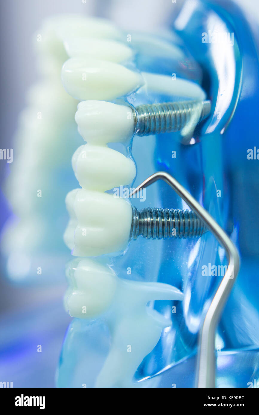 Dental teeth, mouth, gums dentists teaching model showing each tooth ...