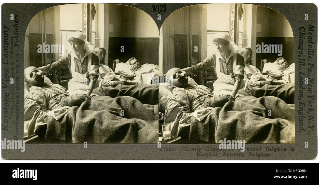 The Horror of War   Ghastly Glimpse of Wounded. Stock Photo