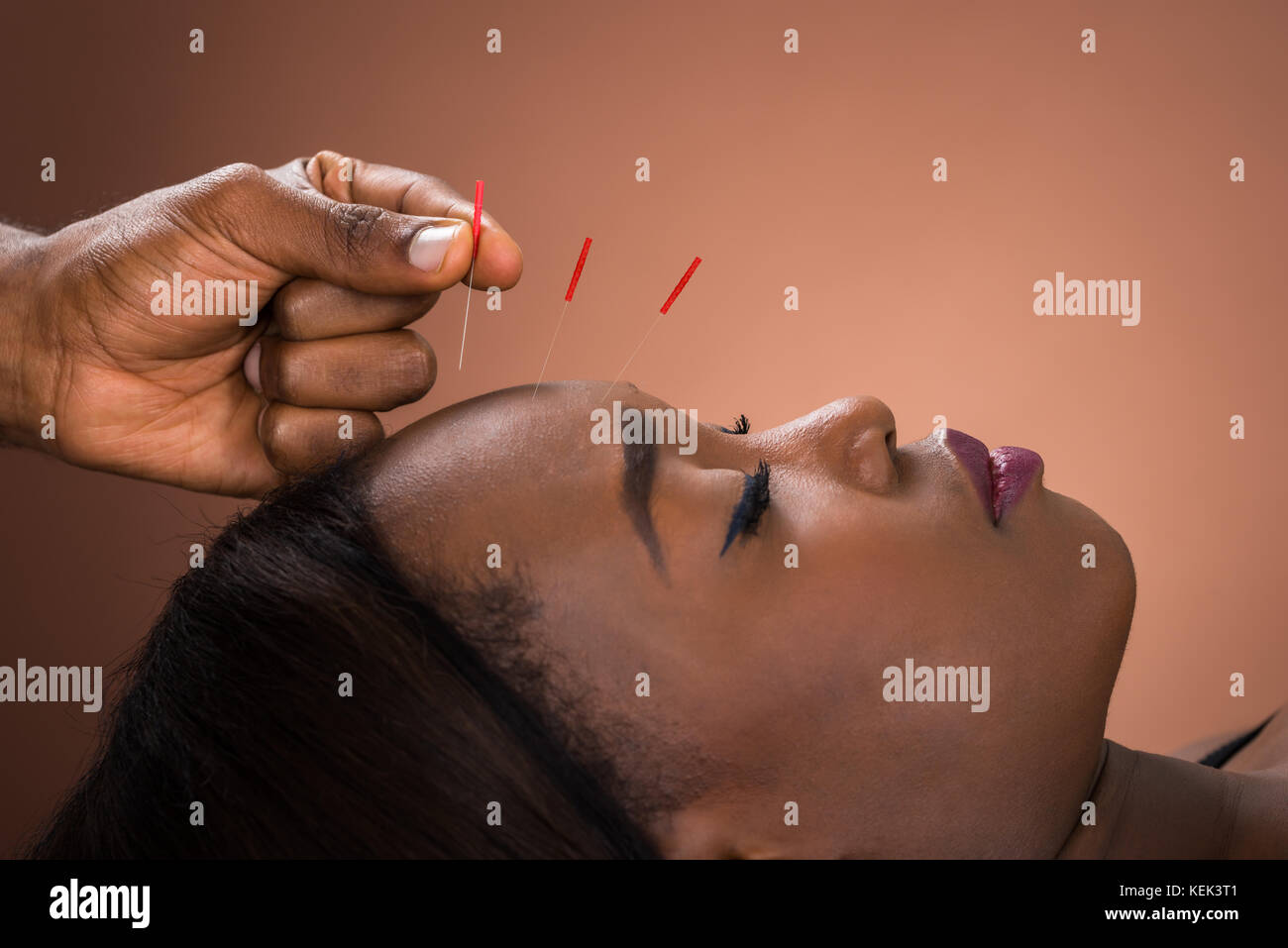 Acupuncture points woman hi-res stock photography and images - Alamy