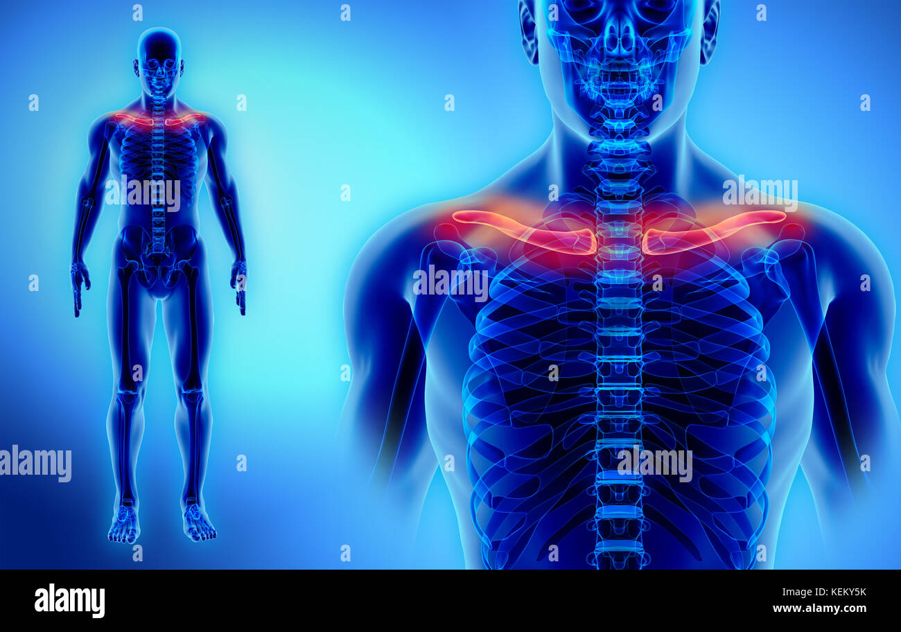 Broken Clavicle High Resolution Stock Photography and Images - Alamy