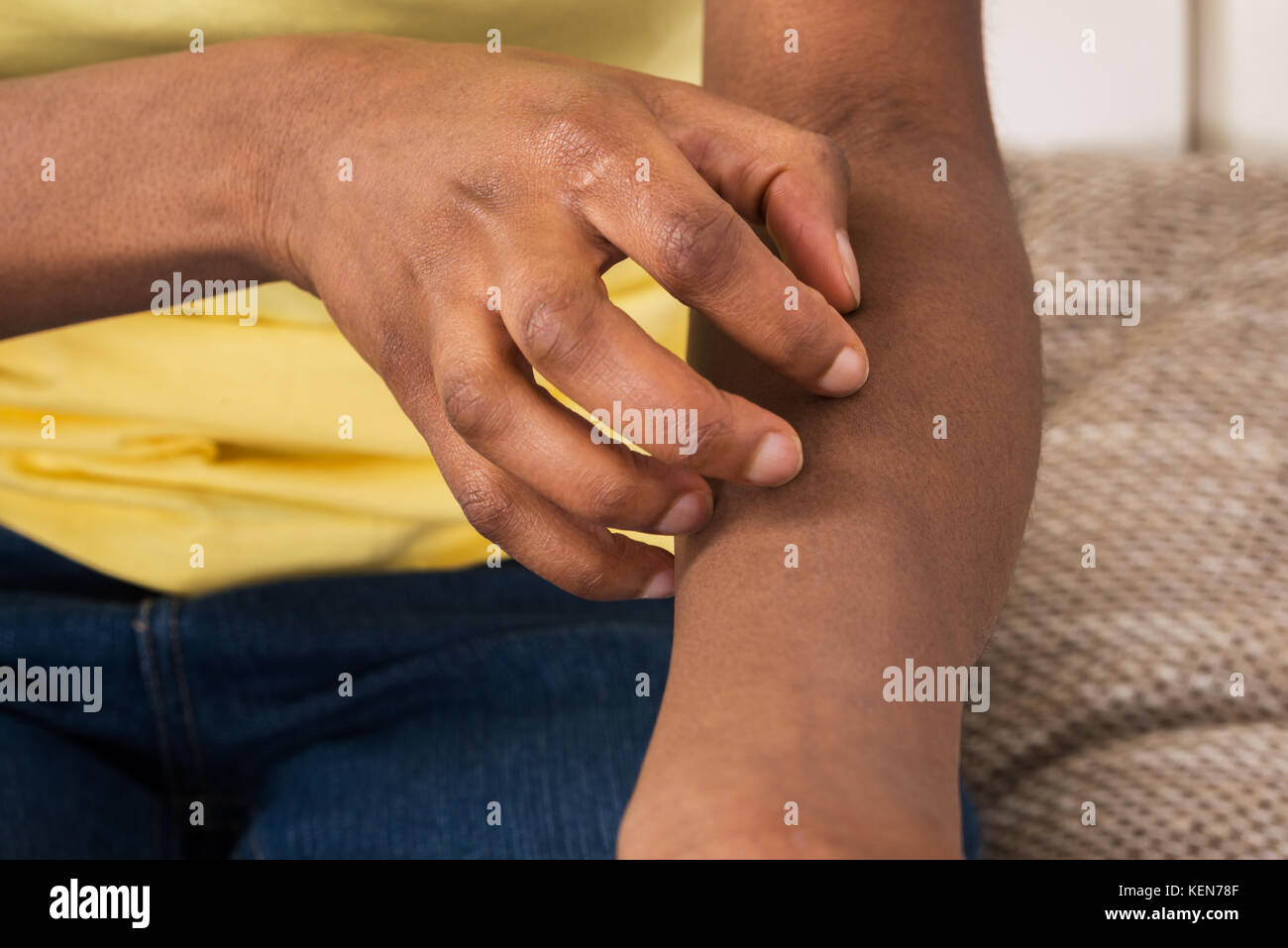 dry skin african american