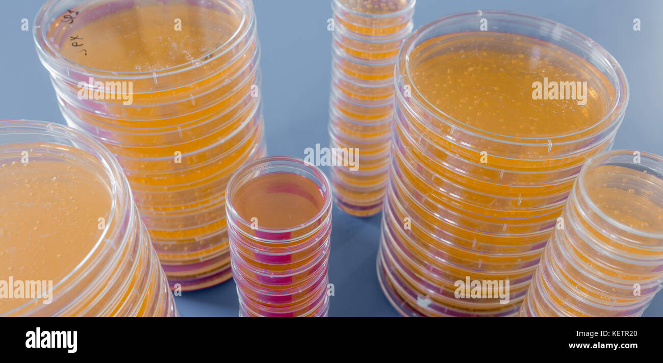 Pile of petri dish with growing cultures of fungi and