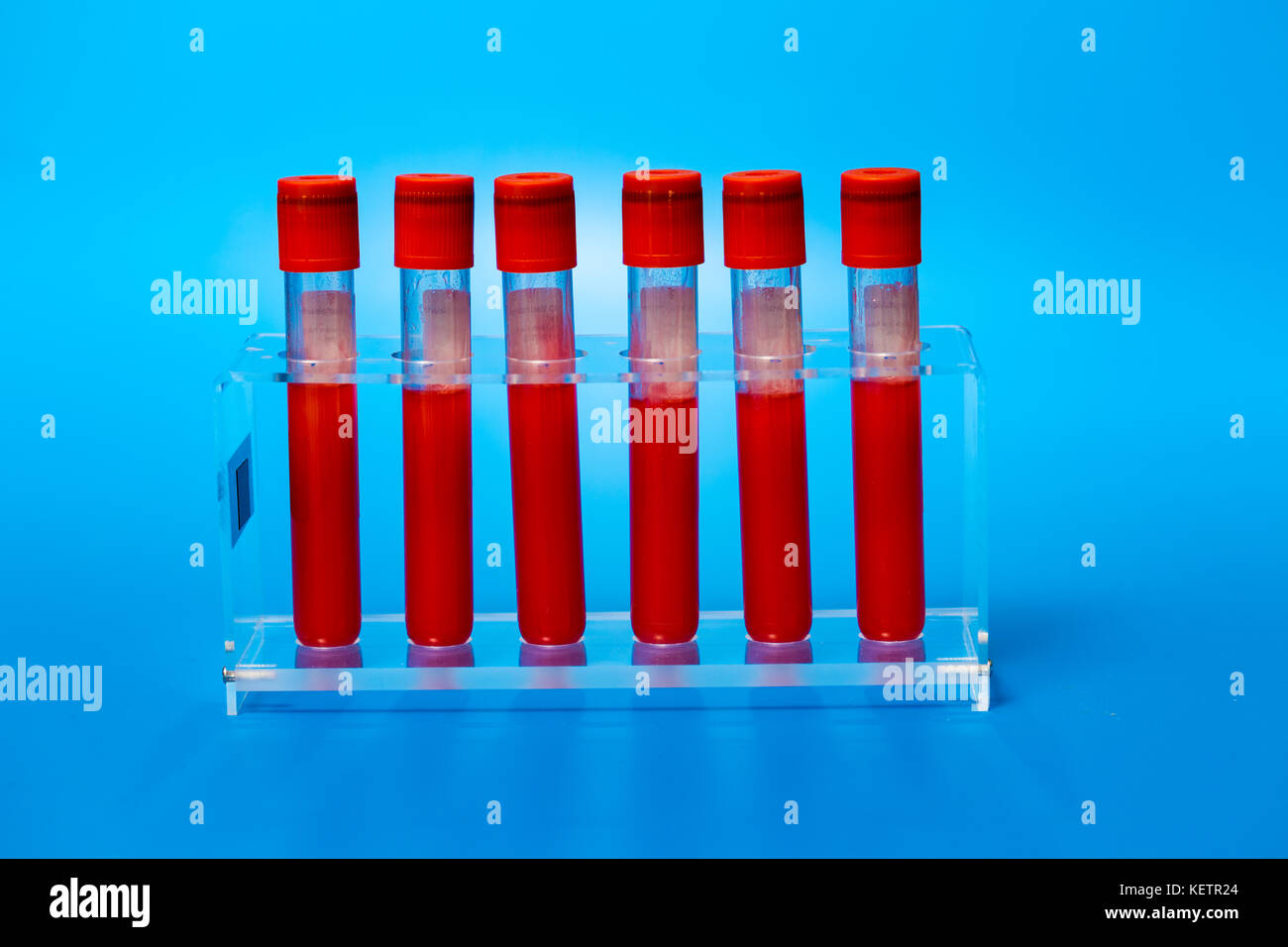 Test tubes with blood for medical and biological analyzes Stock Photo