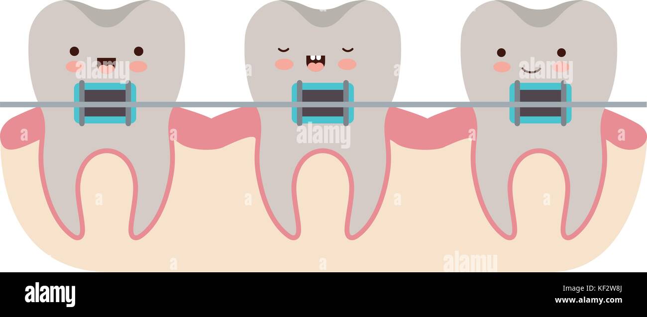 teeth kawaii with braces in colorful silhouette Stock Vector Image ...