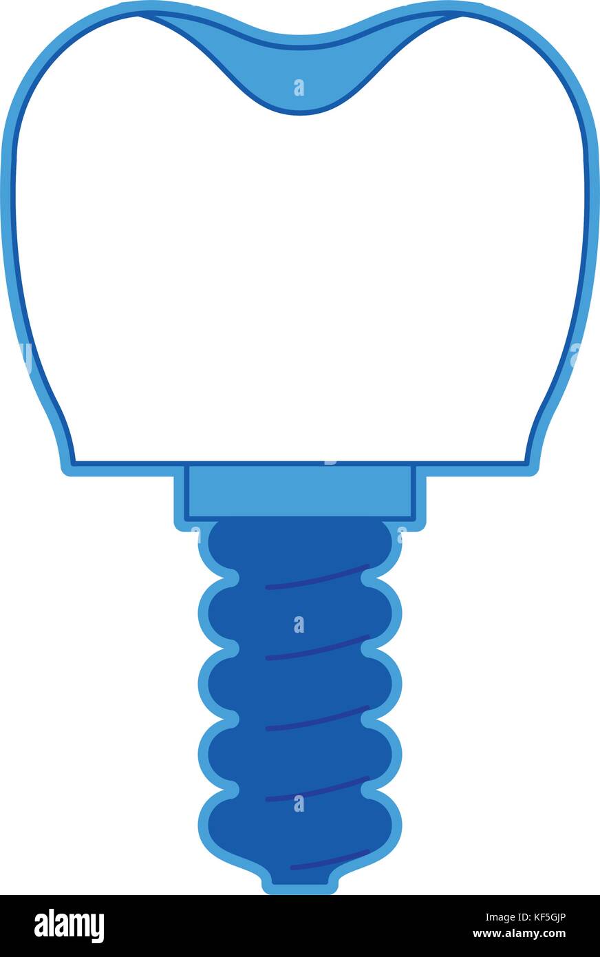 tooth implant with screw in blue silhouette Stock Vector Image & Art ...