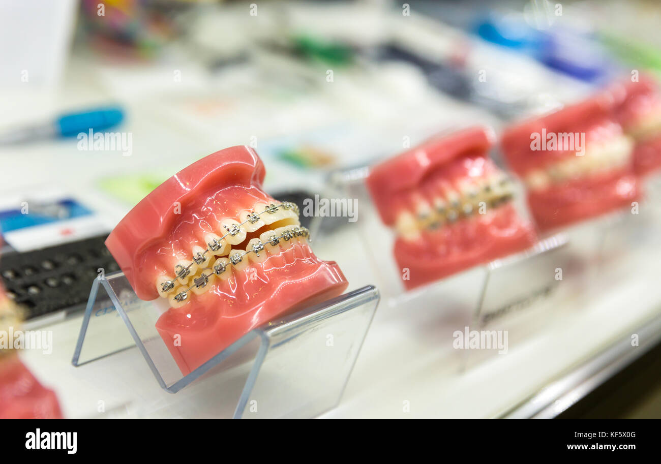 Dental, medicine equipment, orthodontic Stock Photo