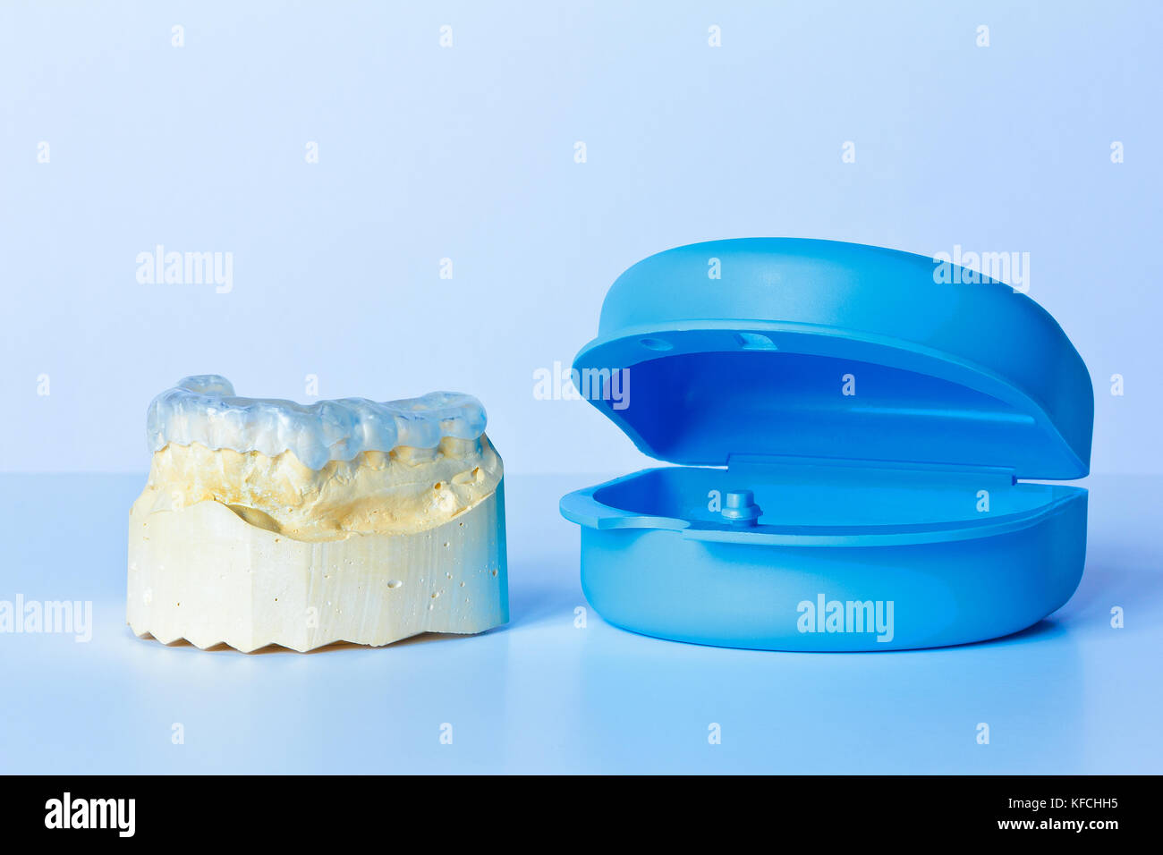 Grind guard on a custom-made tooth model, used against excessive wear caused by bruxism, with additional blue case Stock Photo
