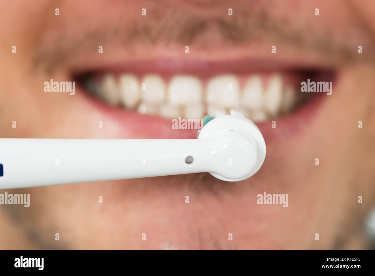 Close-up Of Young Man Teeth With Electric Toothbrush Stock Photo