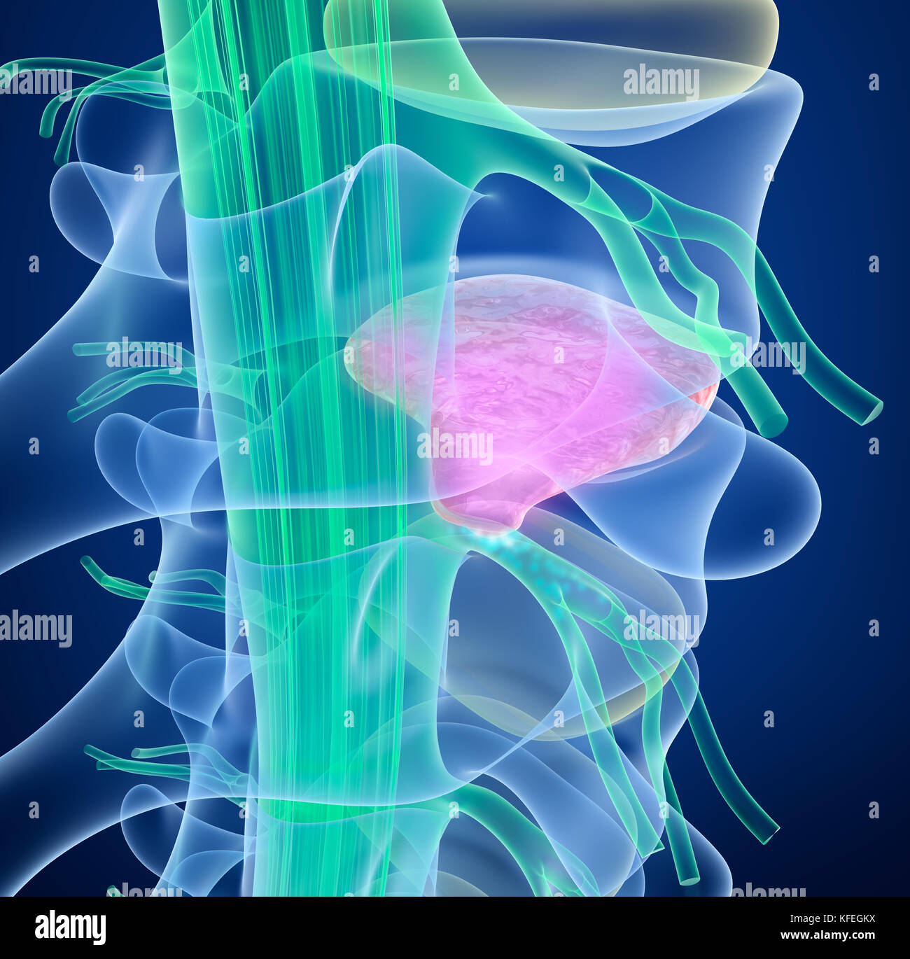 Spinal cord under pressure of bulging disc, 3D illustration Stock Photo
