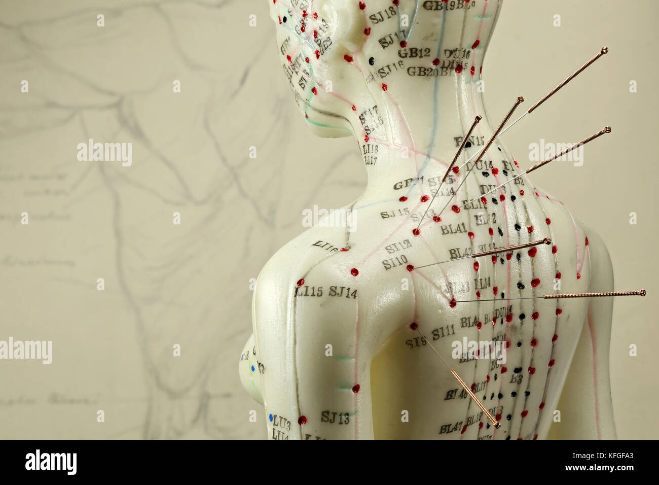 Chinese acupuncture hi-res stock photography and images - Alamy
