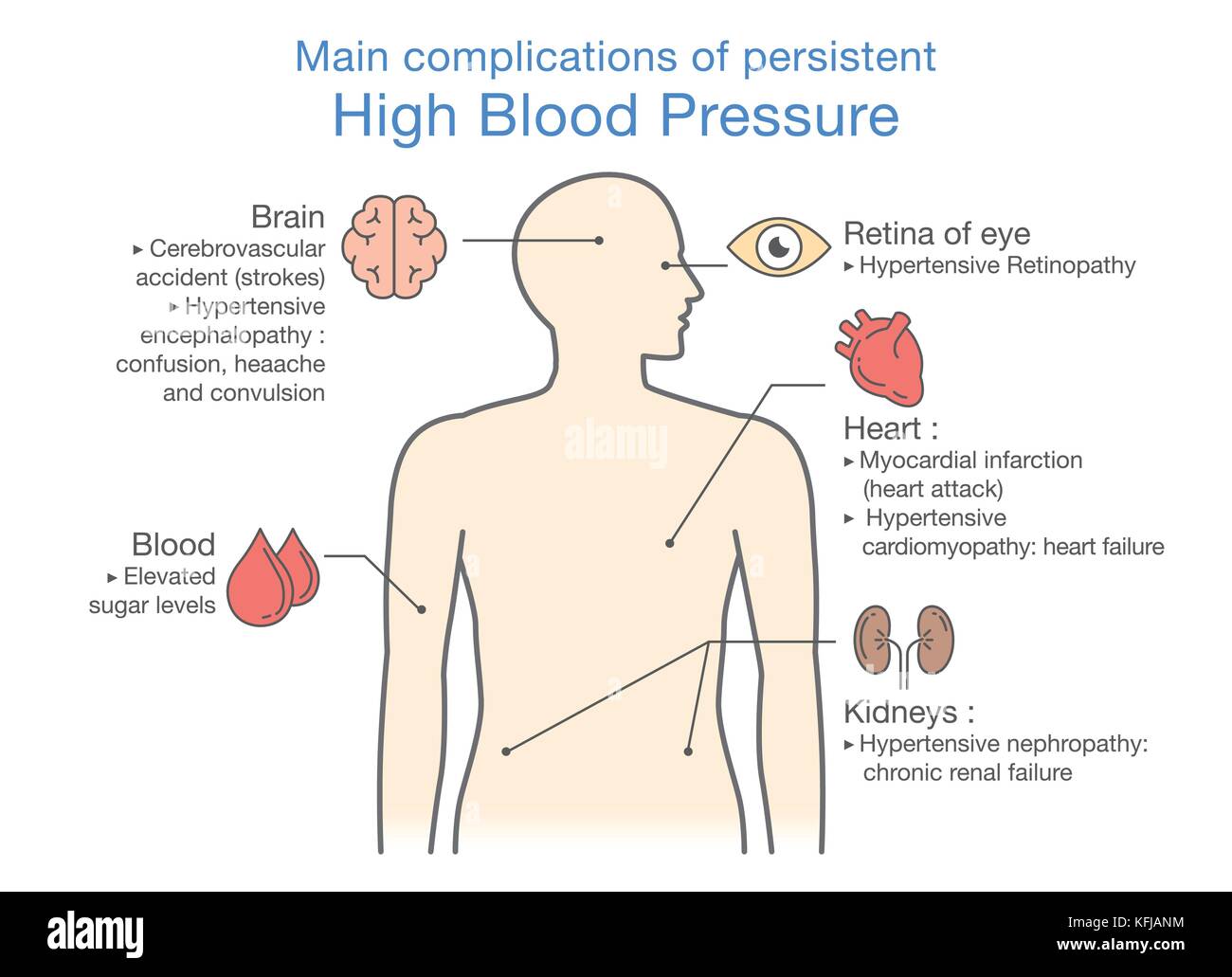 Main complications of persistent High Blood Pressure. Illustration