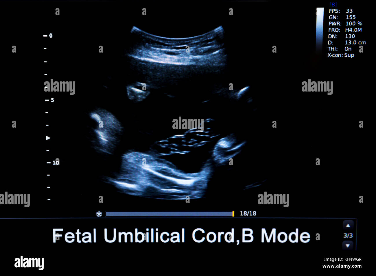 Colourful image of modern ultrasound monitor. Ultrasonography machine