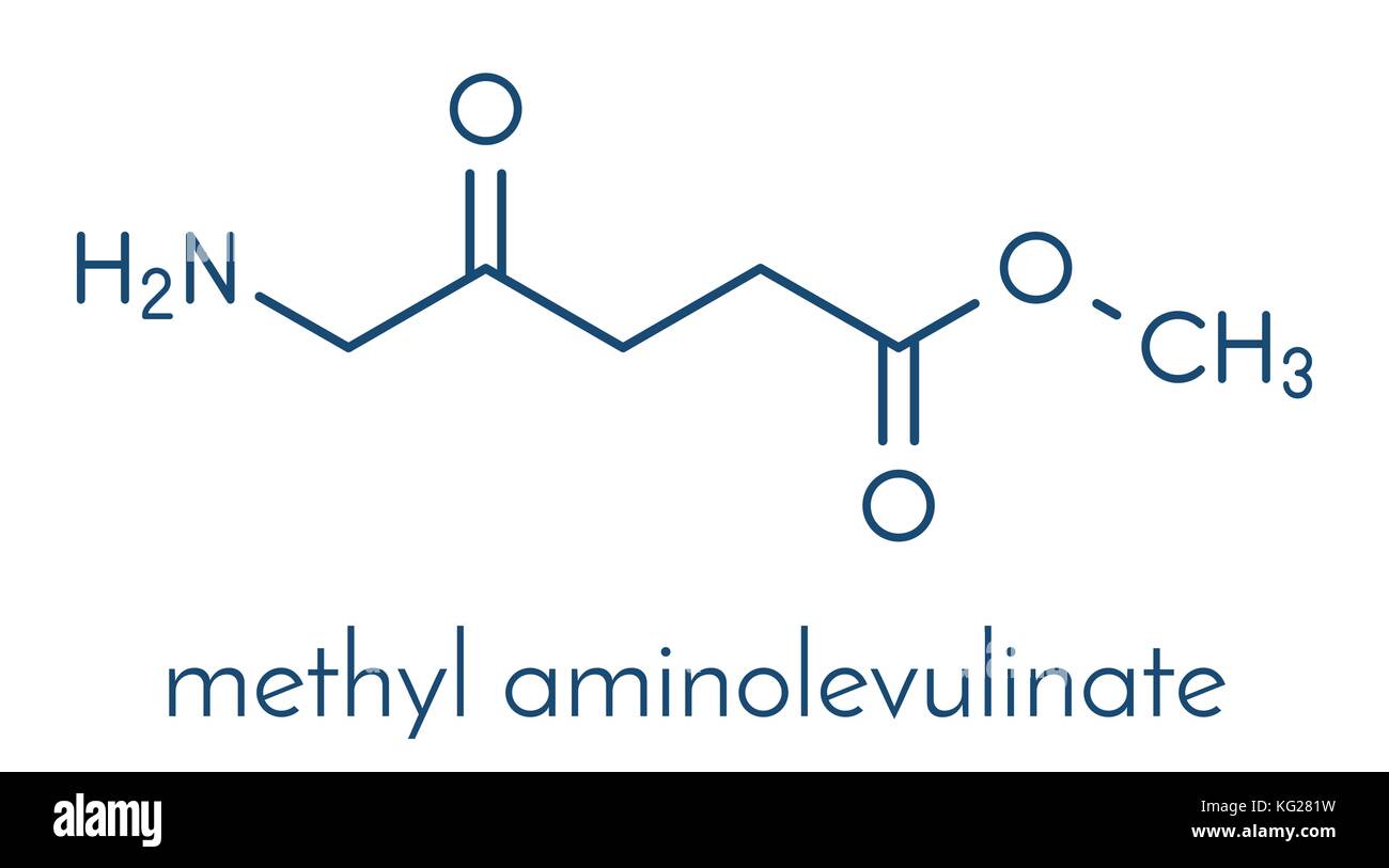 Methyl aminolevulinate non-melanoma skin cancer drug molecule. Used in photodynamic therapy. Skeletal formula. Stock Vector