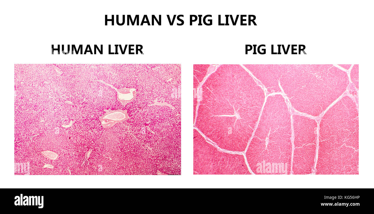 Human and pig livers. Light micrograph showing tissue from a healthy human liver (left) and a pig liver (right). The pig liver has well demarcated lobules with thick interlobal connective tissue. Stock Photo