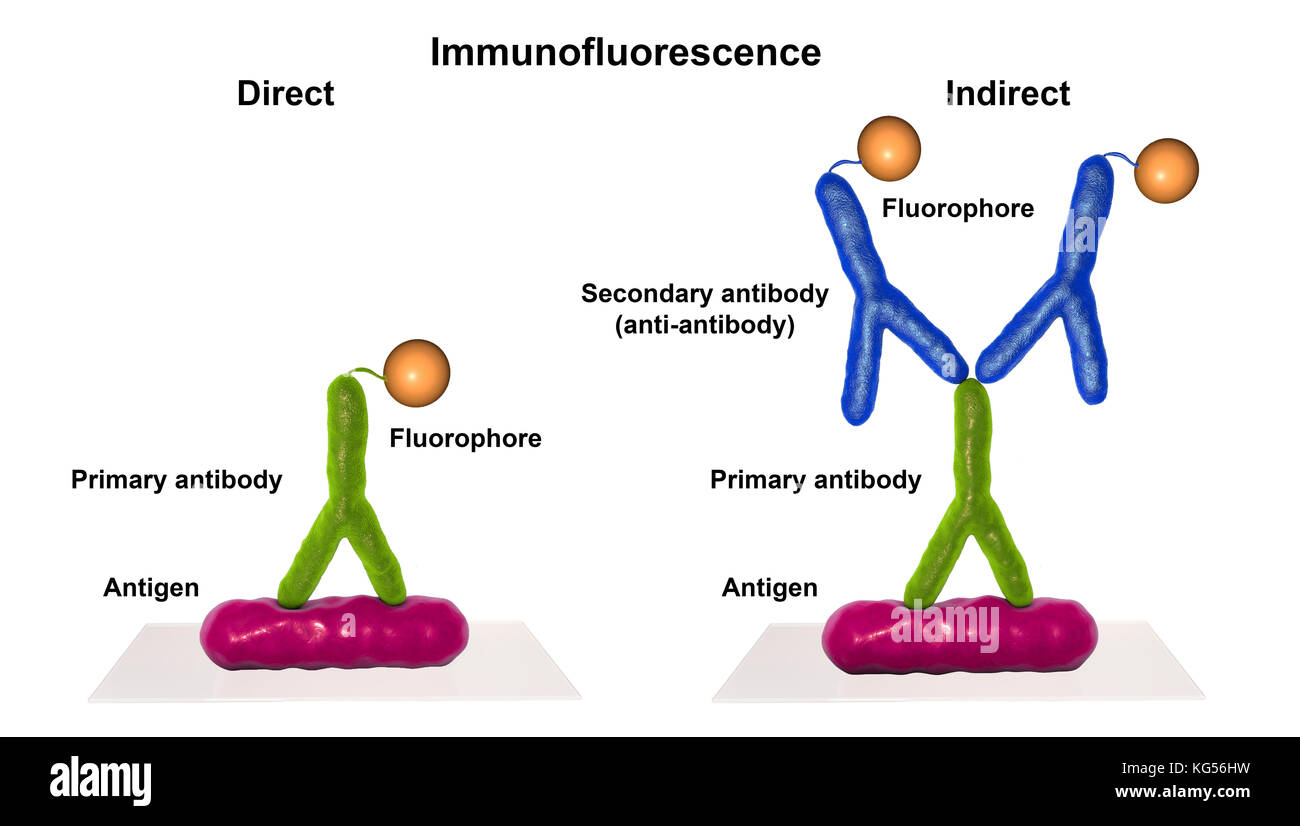 Mechanism of indirect immunofluorescence test, computer illustration. Immunofluorescence is a cell imaging technique based on the use of antibodies to label a specific target antigen (bacteria, cancer cells, other) with a fluorescent dye (also called fluorophore or fluorochrome). The fluorescent dye allows visualization of the antigen distribution in the sample under a fluorescent microscope. Indirect immunofluorescence uses two antibodies, the primary and the secondary. Stock Photo