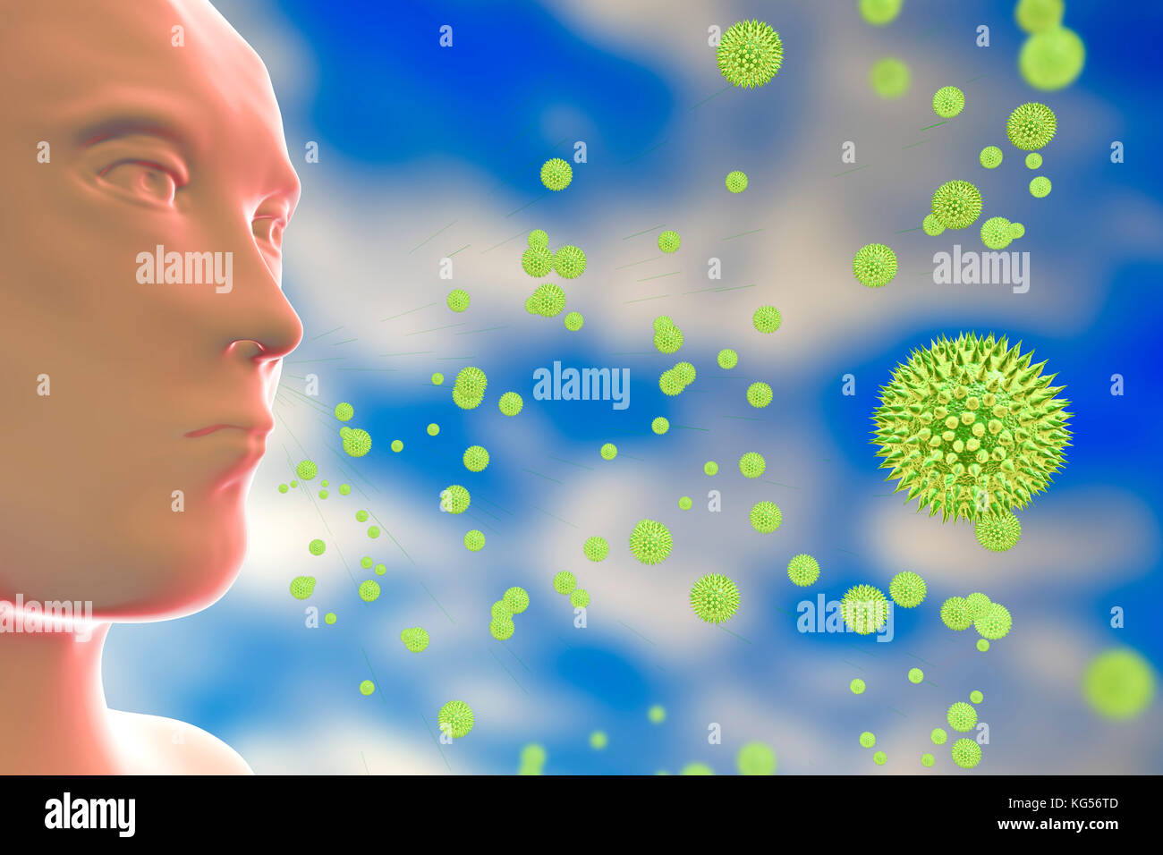 Hay fever. Computer illustration of a person inhaling pollen grains. Pollen grains are released when flowering plants reproduce. Some people become sensitised to pollen in the air, and have an allergic reaction (rhinitis, or pollinosis) whenever they are in contact with it. The symptoms of an attack include inflamed, streaming eyes and a running, blocked nose. The symptoms are caused by a massive release of the chemical histamine in the body in response to the pollen. Drugs which block the action of histamine are of some use in controlling the symptoms. Stock Photo