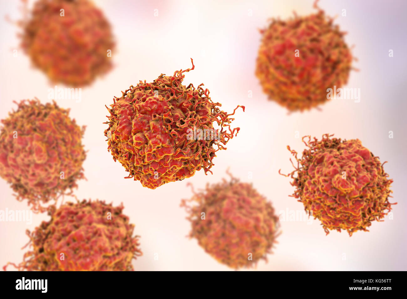 Prostate cancer cells, computer illustration. Stock Photo