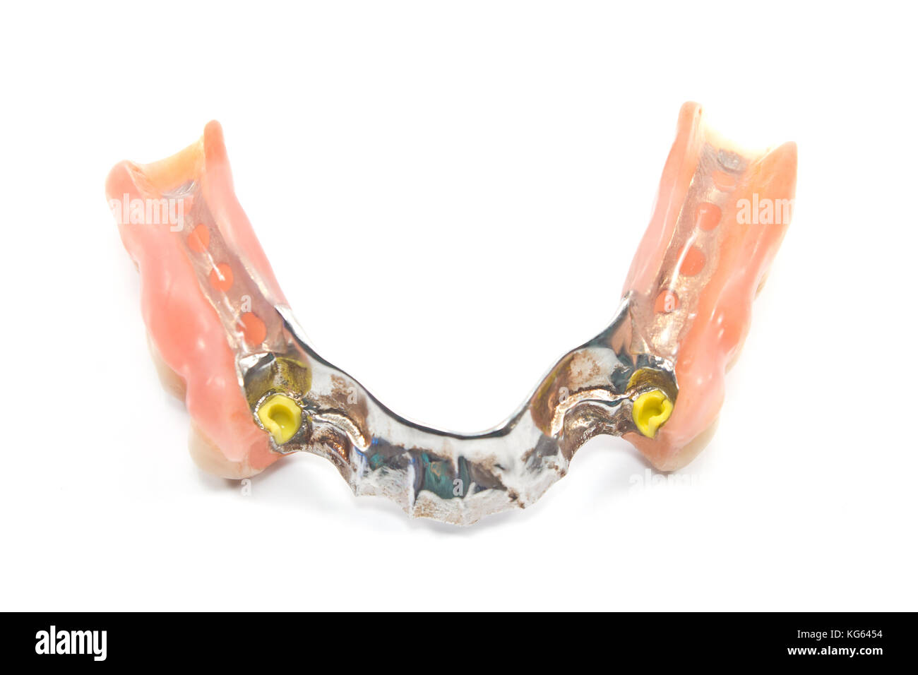 Partial denture bottom side dental prosthetics isolated on white Stock Photo Alamy