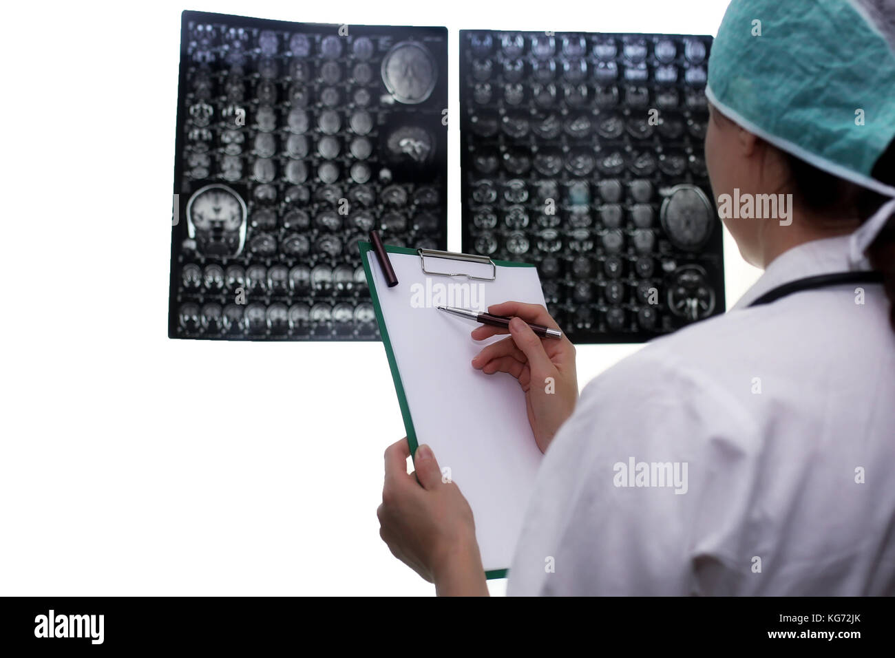 Doctor holding a picture of a brain MRI workflow in diagnostic hospital ...