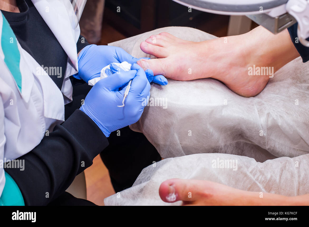Podology treatment. Podiatrist treating toenail fungus. Doctor removes calluses, corns and treats ingrown nail. Hardware manicure. Health, body care c Stock Photo