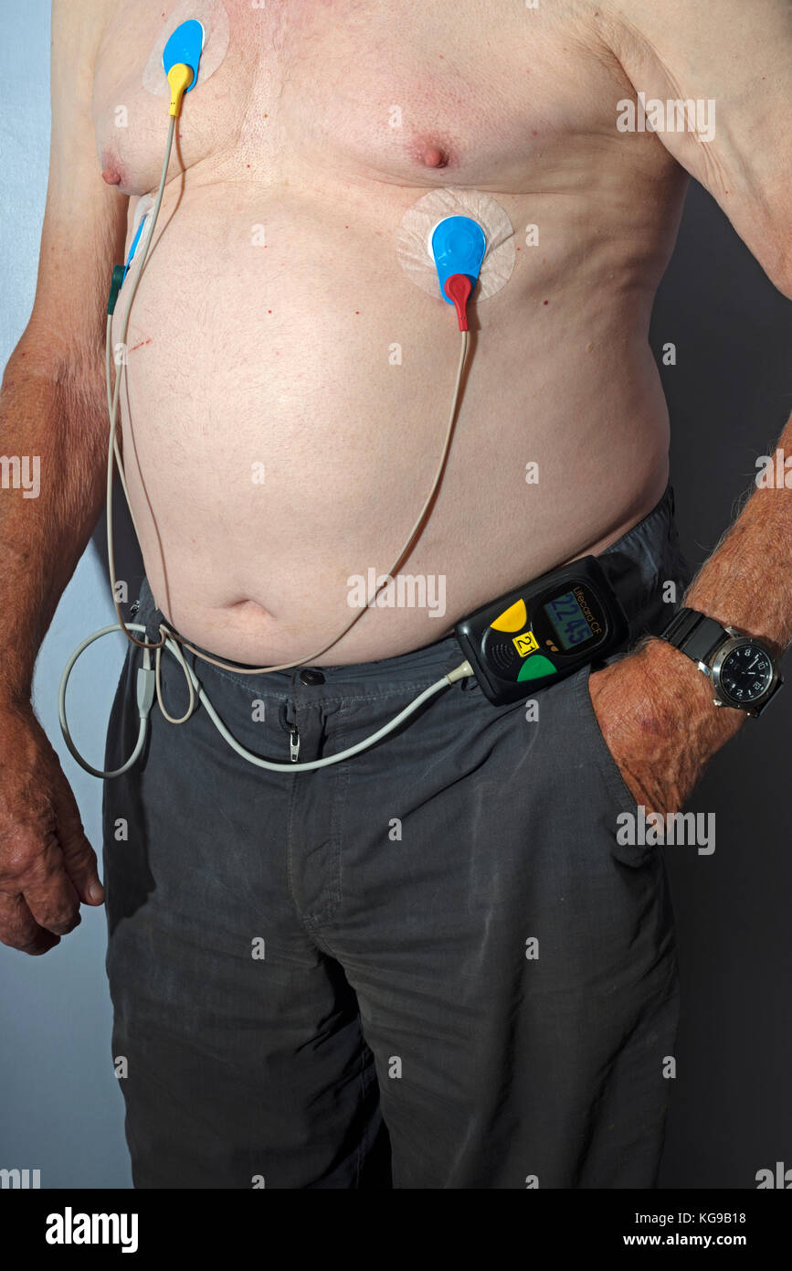 Elderly man wearing a Lifeguard CF 24-hour heart monitoring device Stock Photo