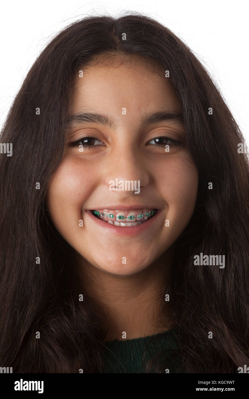 Portrait of a smiling teenage girl with dental braces Stock Photo Alamy