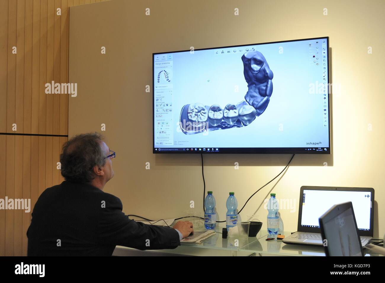 Italian Academy of Dental Prosthetic Dentistry (AIOP), realization of a dental prosthesis by 3D scanning and CAD-CAM design Stock Photo